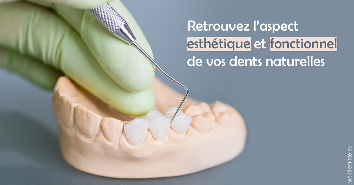 https://dr-bruno-casari.chirurgiens-dentistes.fr/Restaurations dentaires 1