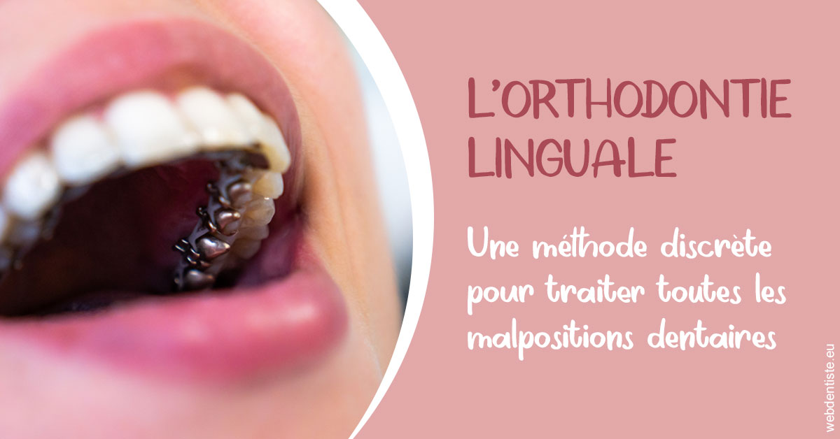 https://dr-bruno-casari.chirurgiens-dentistes.fr/L'orthodontie linguale 2