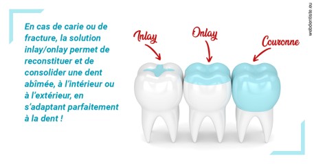 https://dr-bruno-casari.chirurgiens-dentistes.fr/L'INLAY ou l'ONLAY