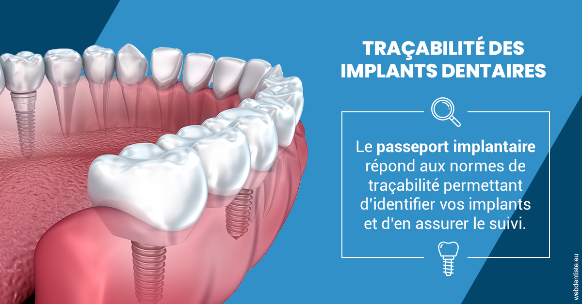 https://dr-bruno-casari.chirurgiens-dentistes.fr/T2 2023 - Traçabilité des implants 1