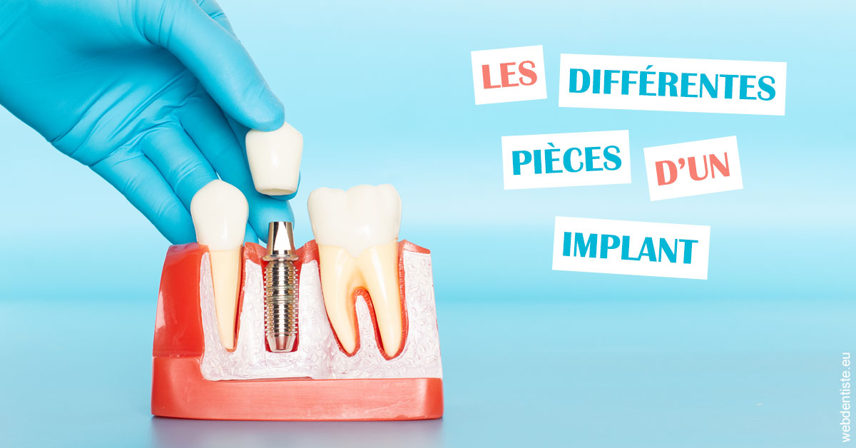 https://dr-bruno-casari.chirurgiens-dentistes.fr/Les différentes pièces d’un implant 2