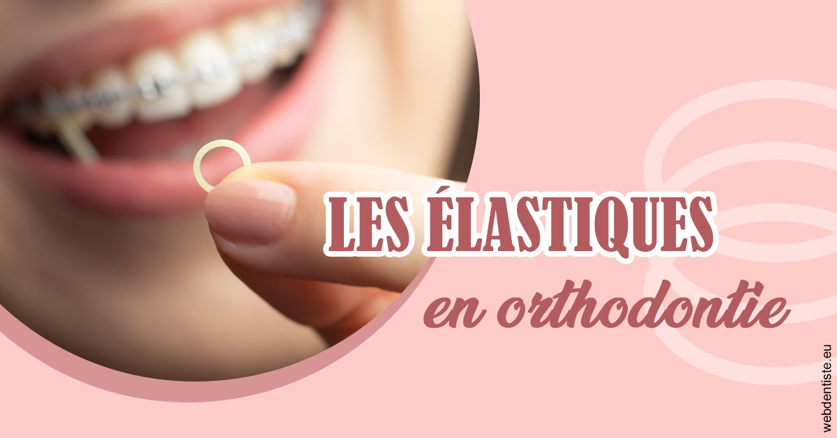 https://dr-bruno-casari.chirurgiens-dentistes.fr/Elastiques orthodontie 1