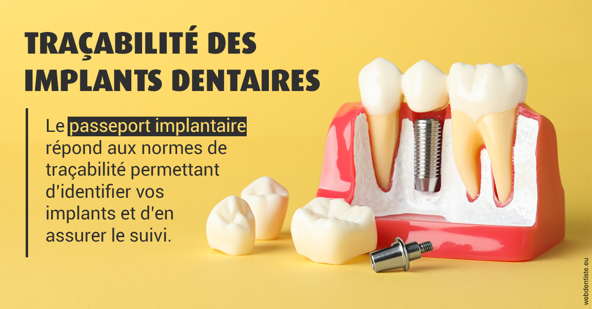 https://dr-bruno-casari.chirurgiens-dentistes.fr/T2 2023 - Traçabilité des implants 2