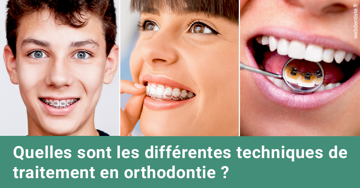 https://dr-bruno-casari.chirurgiens-dentistes.fr/Les différentes techniques de traitement 2