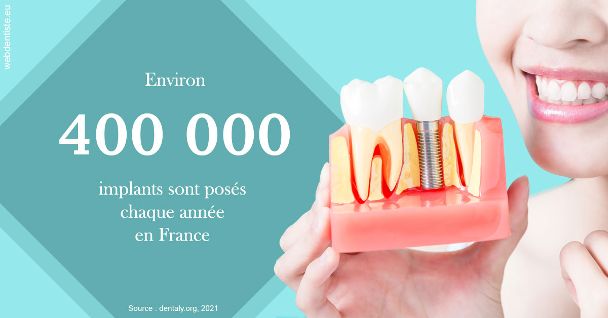 https://dr-bruno-casari.chirurgiens-dentistes.fr/Pose d'implants en France 2