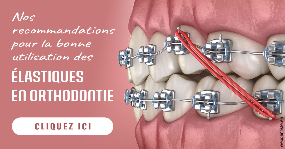 https://dr-bruno-casari.chirurgiens-dentistes.fr/Elastiques orthodontie 2