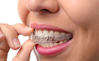 Orthodontie-Invisible-le-traitement-par-gouttieres-20707